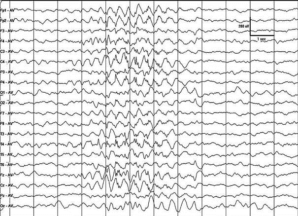 6ff0007b-23b6-4c5e-b765-8fa2179f41bc.png