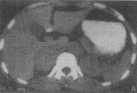YZ332_1_60_55.gif