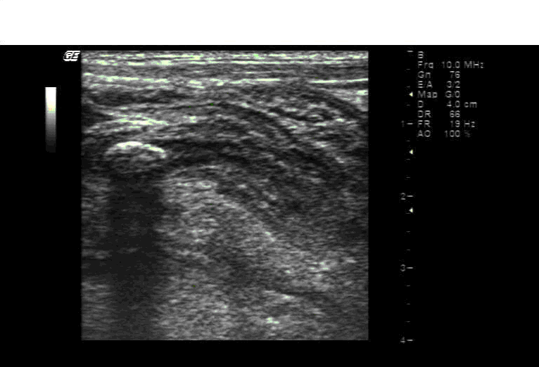 CF20160315_2.gif