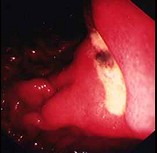 1XH-00604.jpg