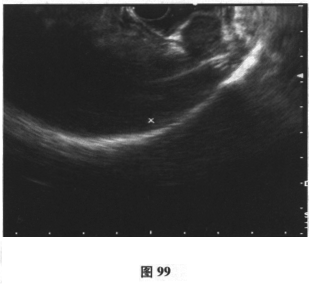 GJ116_381_1.gif