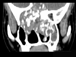 EBH-00094.jpg