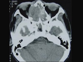EBH-00104.jpg
