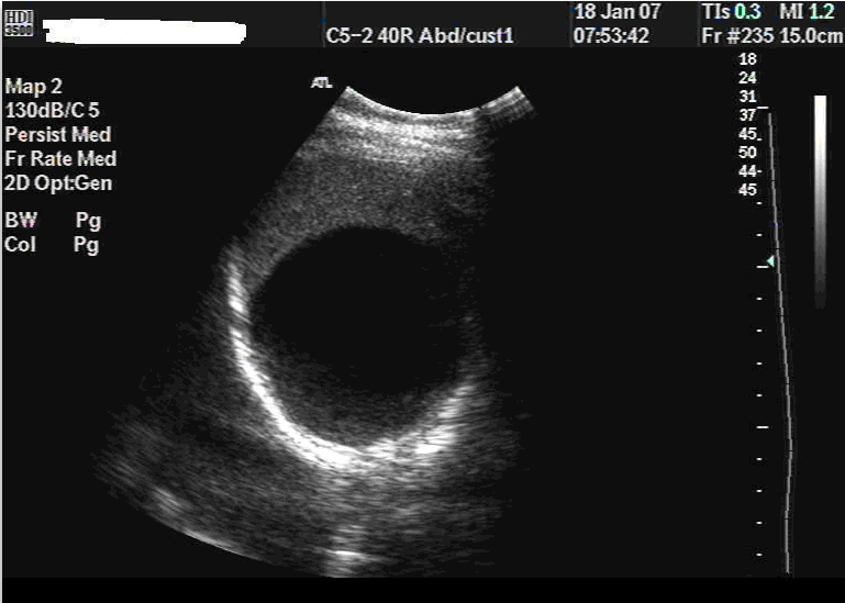 CF20160315_40.gif